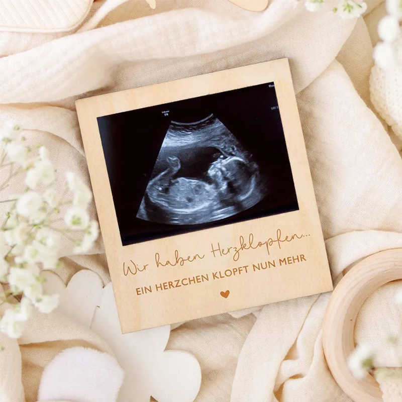 Ultrasound Pregnancy Announcem - Photo Booth Frame avaliação e preço